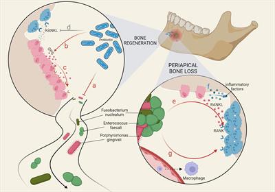 Mechanisms of bone remodeling and therapeutic strategies in chronic <mark class="highlighted">apical periodontitis</mark>
